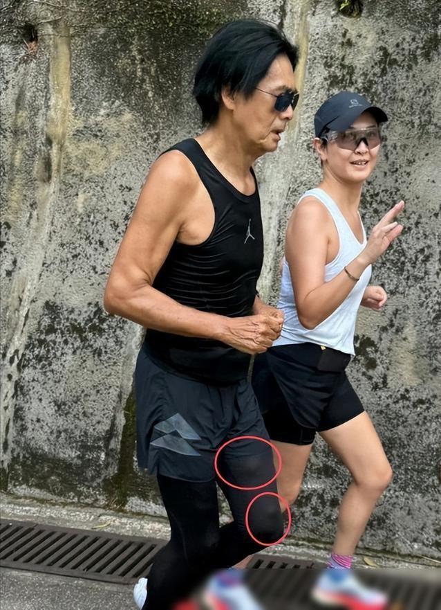 辟謠 周潤發否認患腫瘤 稱是皮下脂肪